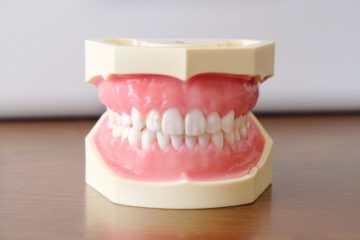 義歯(入れ歯)のメリットとは？義歯の取り扱い方法についてもご紹介！