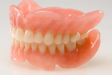 義歯（入れ歯）とインプラントの違いとは？
