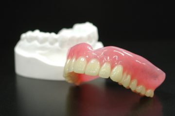 義歯（入れ歯）の寿命：長持ちさせるためのケアと注意点