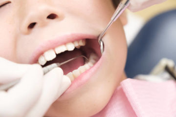 【小児歯科】乳歯の虫歯予防 |について：虫歯は感染症だから防ぐことはできないの？