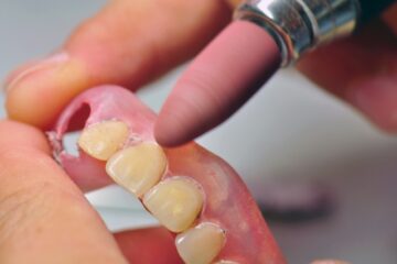 義歯(入れ歯)のつけっぱなしによるリスクについて