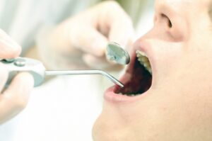 歯磨きと歯のクリーニングって何が違うの？